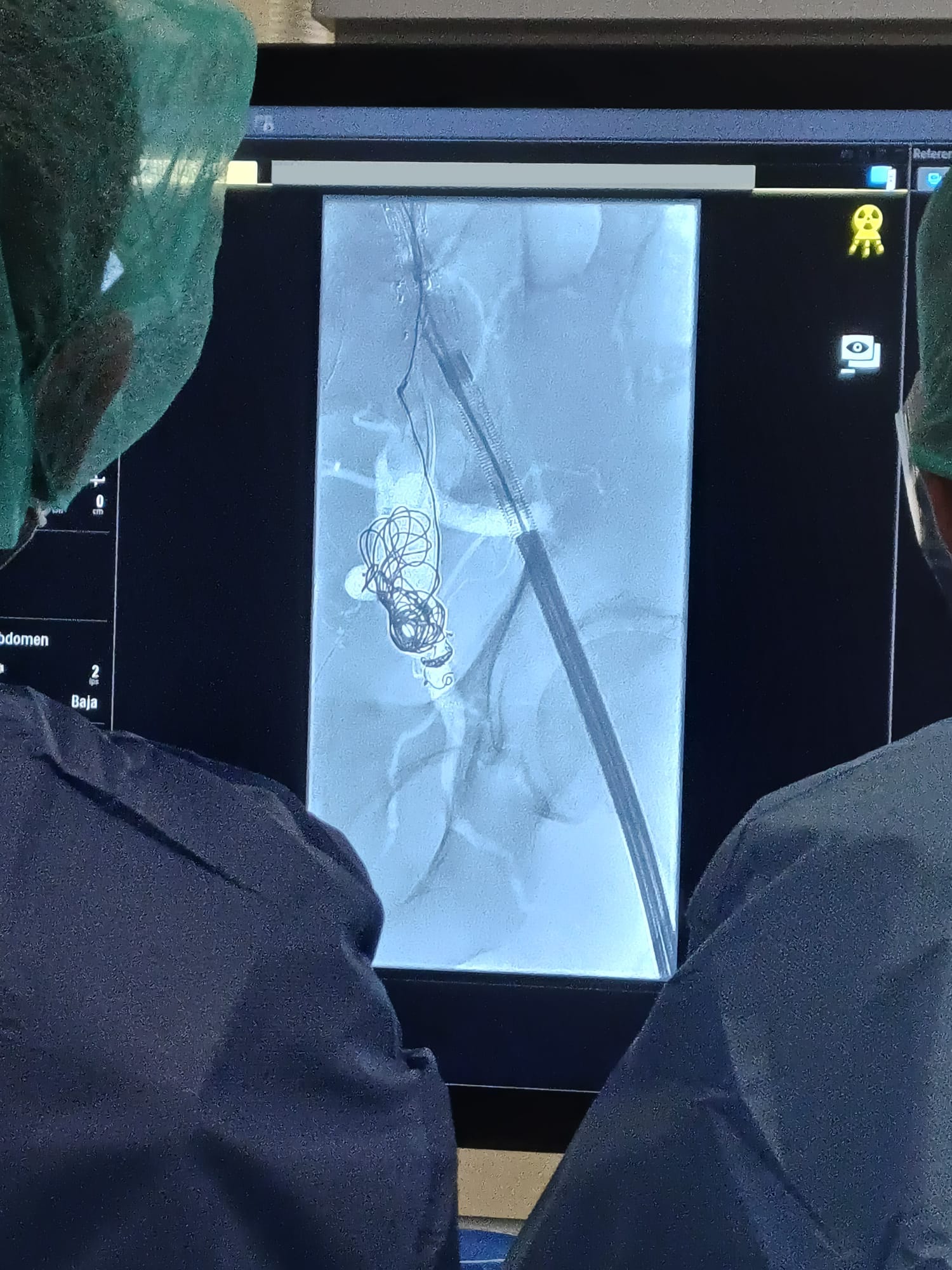 Terapéutica Endovascular
